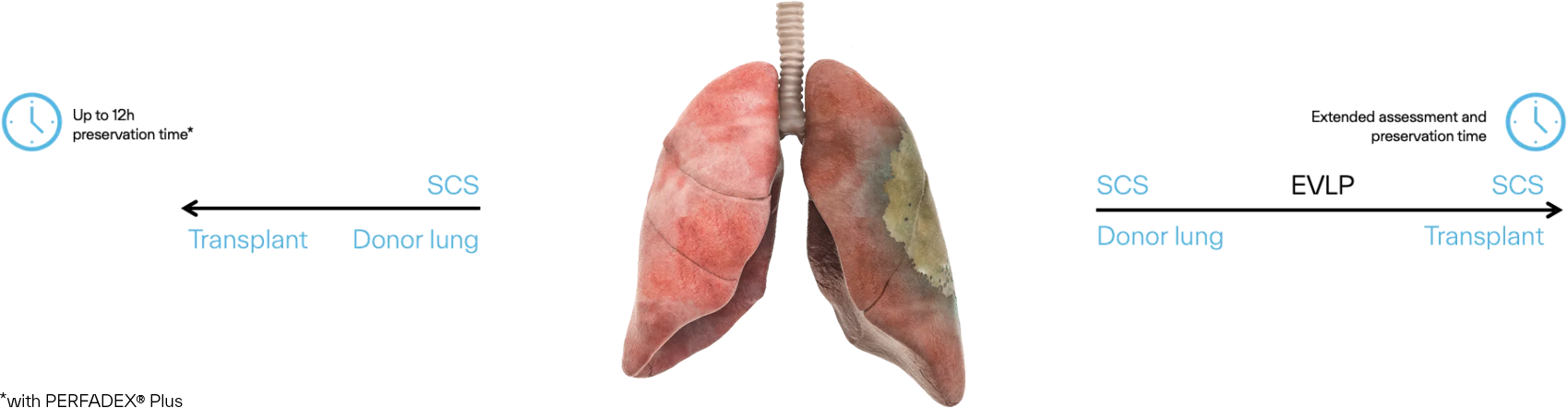 Lung Perfusion