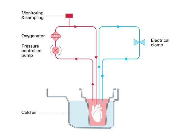 Principles of operation